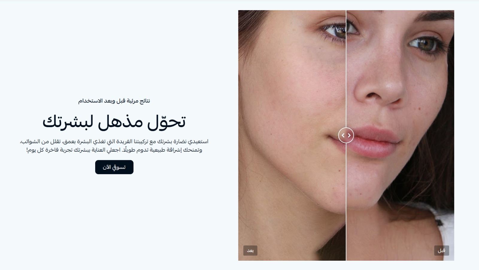 مقارنه